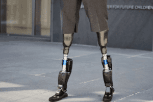 jambes bioniques